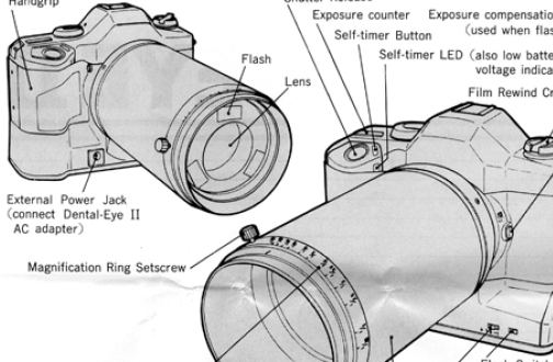 Yashica Dental Eye II camera